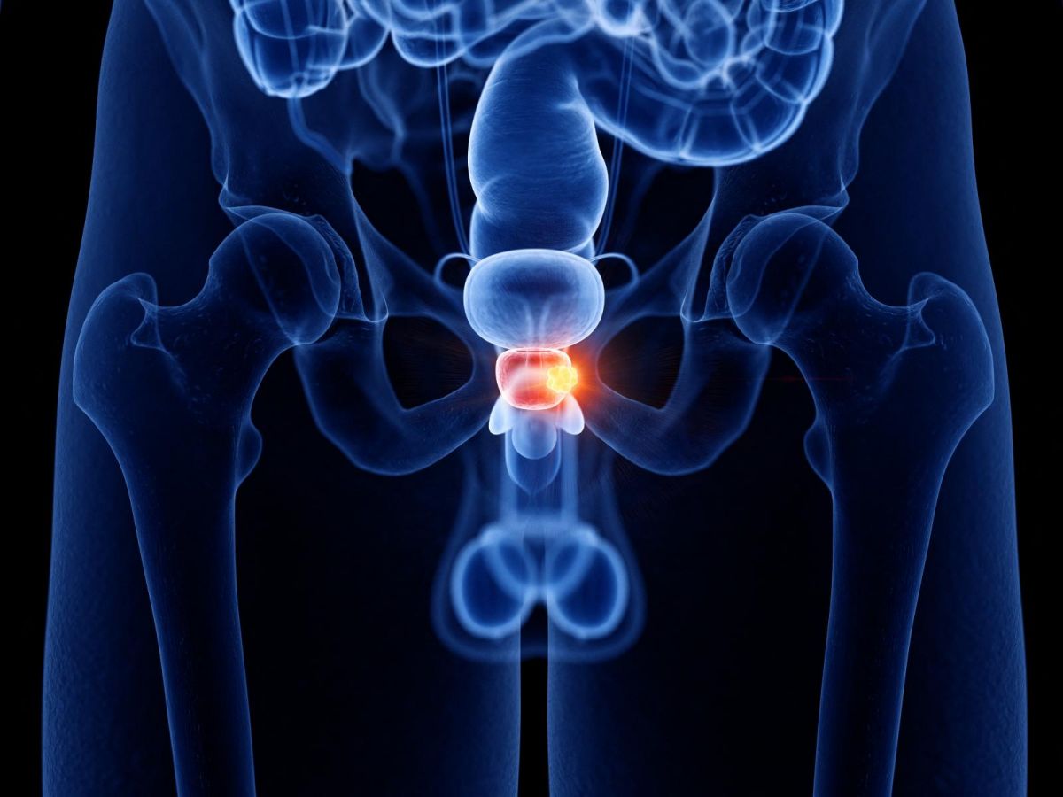 Pregled prostate