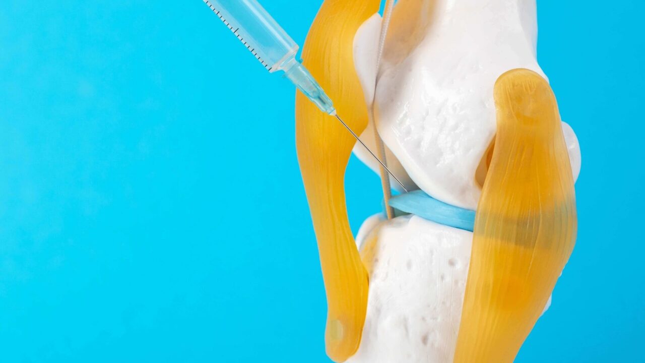Hijaluronske injekcije za zglobove